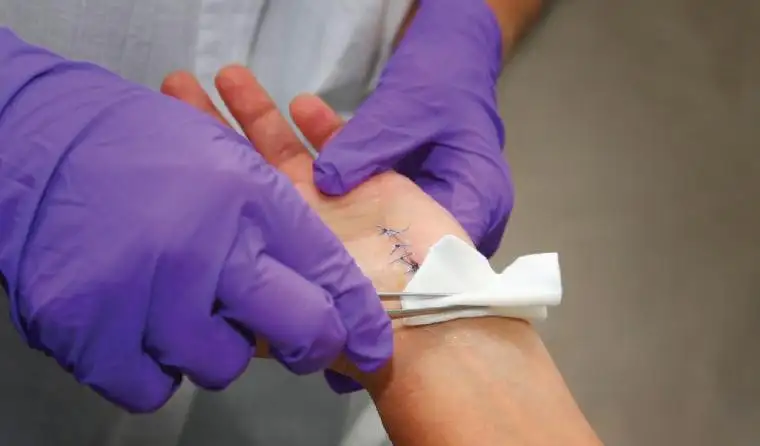 Post-Surgical Skin Care